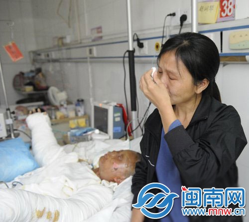 廈門(mén)一打工女因煤氣爆燃全身燒傷80%3