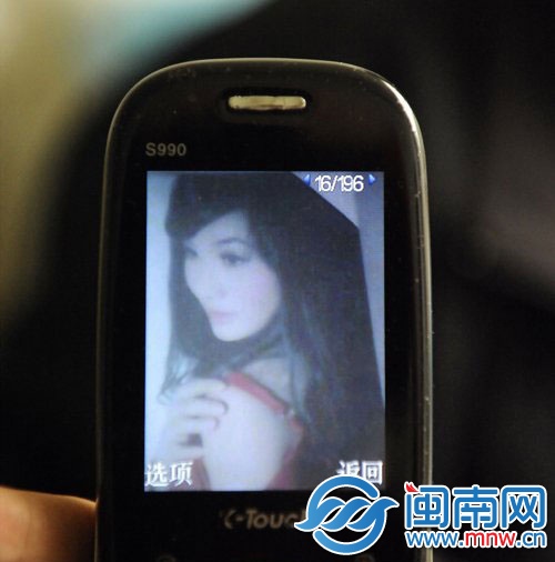 廈門一打工女因煤氣爆燃全身燒傷80%2