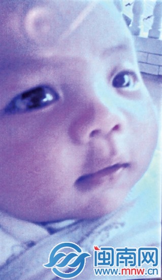 第一次手術后，寶寶眼睛逐漸恢復，白凈可愛